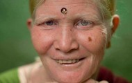 Largest family of albinos in the world
