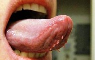 The tongue of terror