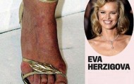 Ugly feet of the celebrities