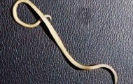 Doctors have proved that losing weight with the help of worms