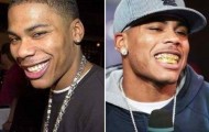 Celebrity Teeth: before and after the correction dentist