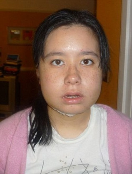 new plastic face 