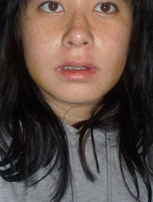 new plastic face 