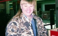 People with the world’s rarest hair