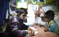 Family with werewolf syndrome