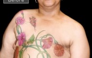 Tattoos on a woman’s breast instead of mastectomy scars