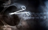 X-rays strikes fear