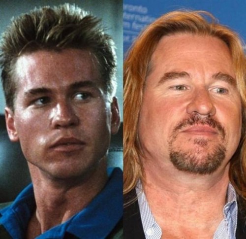 then and now celebrities