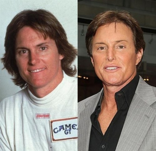 then and now celebrities
