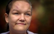 How has the appearance of the girl after the use of hard drugs
