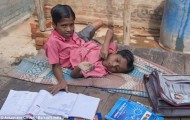 Conjoined twins, finds Indian deity, refuse separation operation.