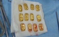 Surgeons found unusual items inside the abdomen of a businessman