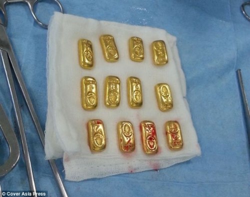 gold found stomach