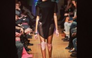 Winnie Chantelle – American model with impaired skin pigmentation