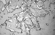 Human tears under the microscope