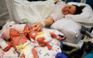 Woman gave birth to twins who were born holding hands