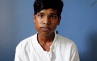 “Shark mouth” or teenager with 232 extra teeth were removed from his mouth