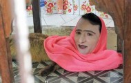 Man-fox – strange creature from the Pakistani zoo
